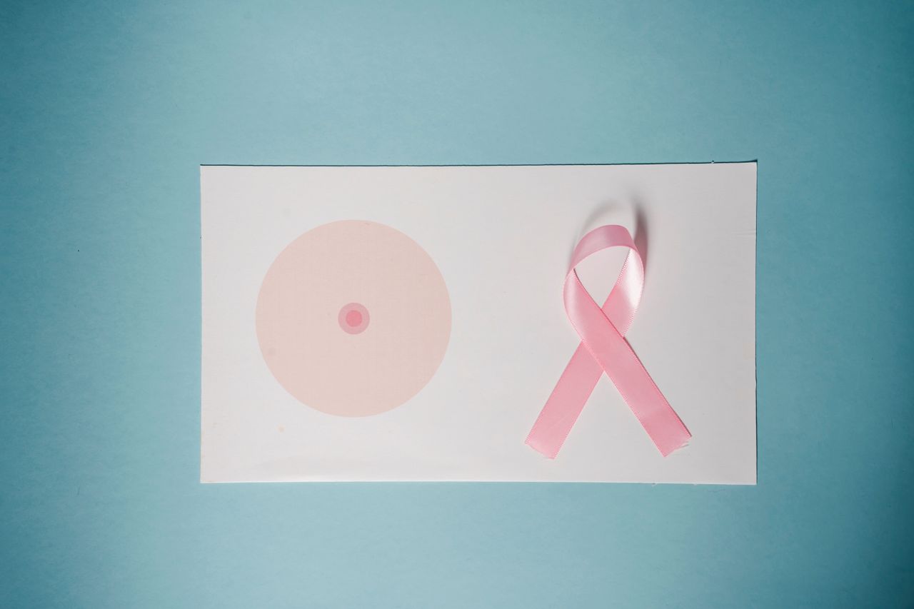 cancer du sein